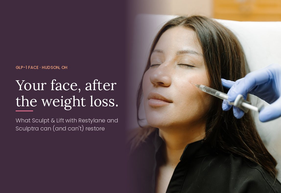 GLP-1 face treatment with Sculptra and Restylane at Serene Med Spa in Hudson, Ohio