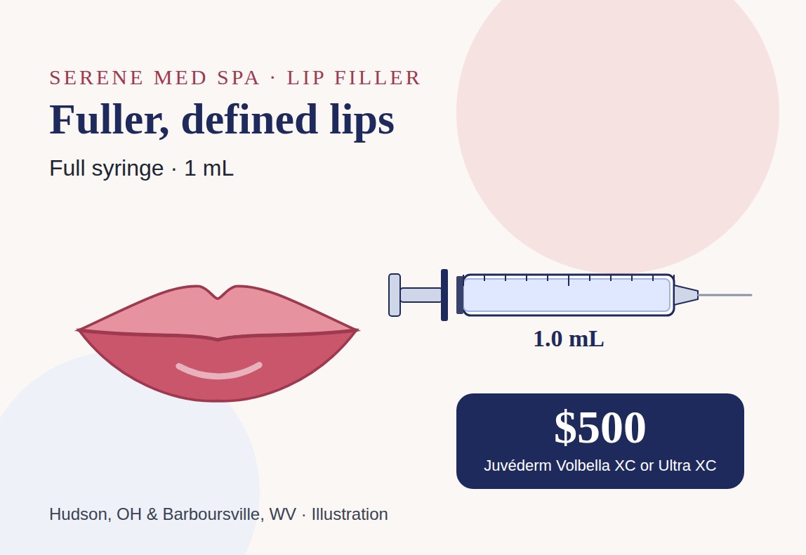 Illustration of fuller lips and a full 1 mL syringe of Juv&eacute;derm lip filler, $500 at Serene Med Spa